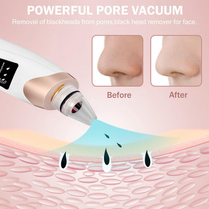 5 in 1 Electric Blackhead Acne Oil Remover Vacuum Suction Face Pore Cleaner Machine